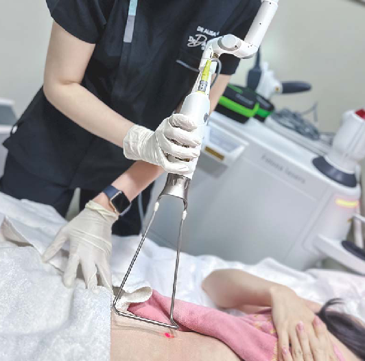 Fotona 4 D Tightsculpt